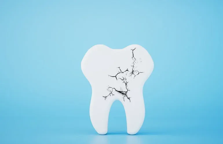 what causes cracked teeth