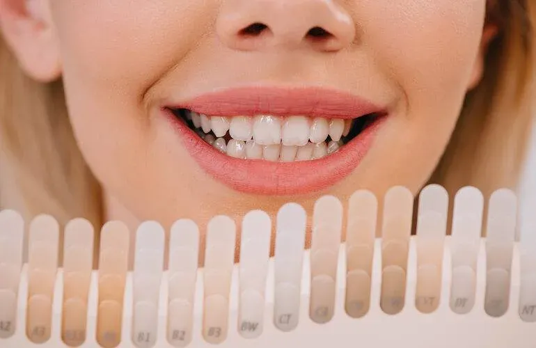 how to whiten teeth