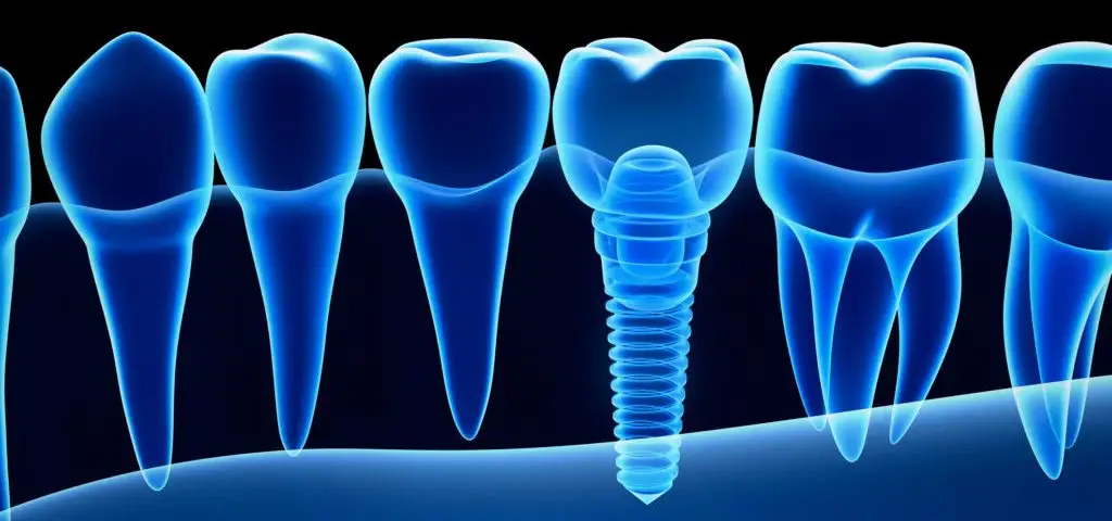 dental imaging